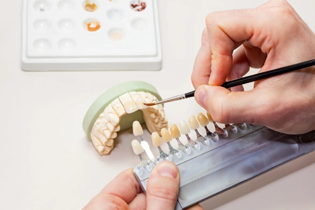 What is a Dental Crown?